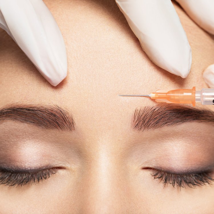 Woman,Getting,Cosmetic,Injection,Of,Botox,Near,Eyes,,Closup.,Woman